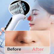 Blackhead Remover Nose Face Deep Cleaner Pore Acne Pimple Removal Vacuum Suction Facial Beauty Clean Skin