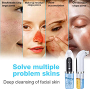 Blackhead Remover Nose Face Deep Cleaner Pore Acne Pimple Removal Vacuum Suction Facial Beauty Clean Skin