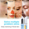 Blackhead Remover Nose Face Deep Cleaner Pore Acne Pimple Removal Vacuum Suction Facial Beauty Clean Skin